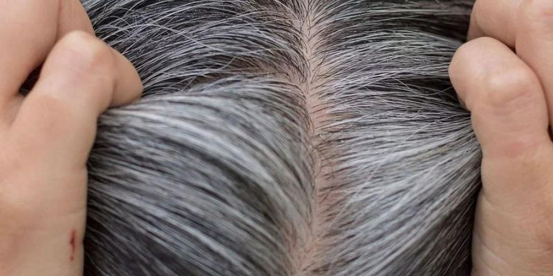 Wellhealthorganic.com/know-The-Causes-Of-White-Hair-And-Easy-Ways-To-Prevent-It-Naturally
